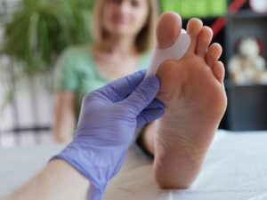halluks valgus 