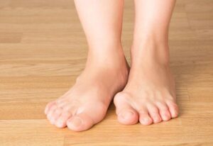 Halluks Valgus Belirtileri halluks valgus belirtileri