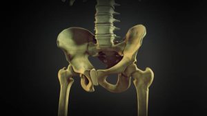 Kalça Kırığı Ameliyatı