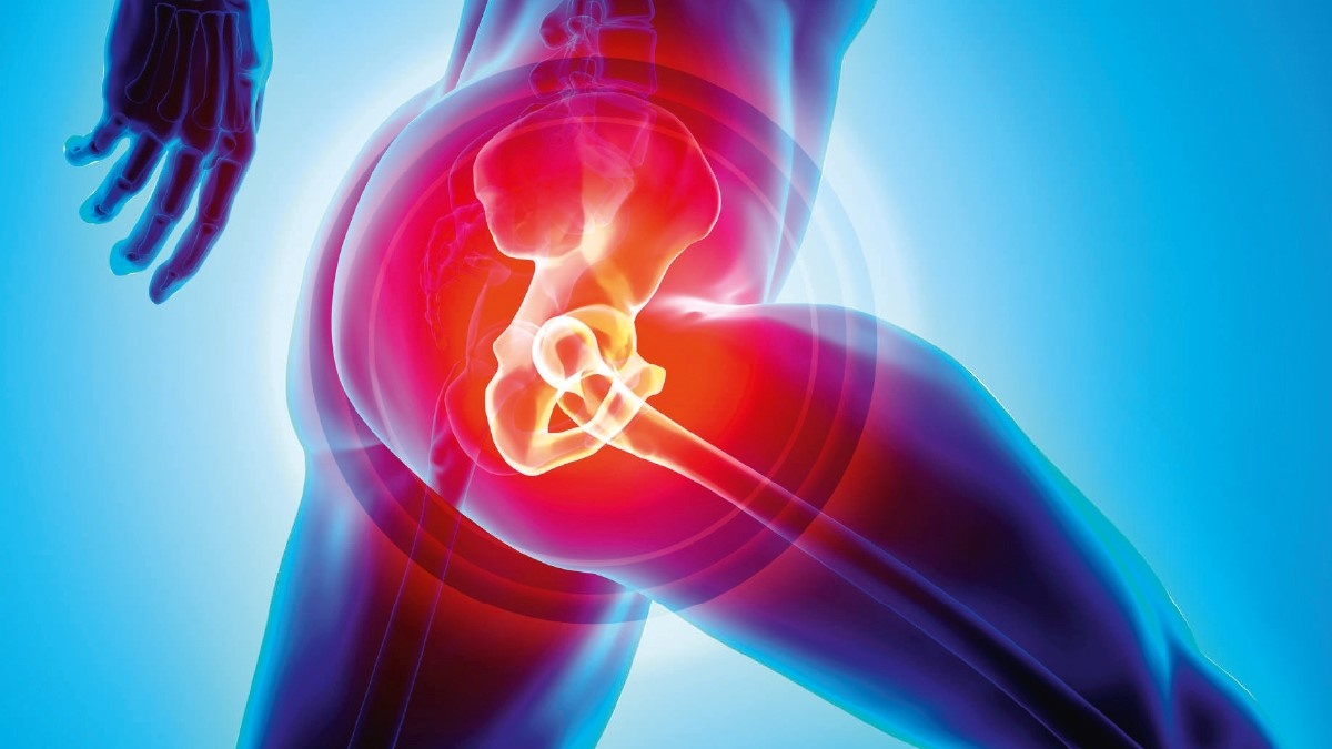 Total Hip Replacement Surgery Total Kalça Protezi Ameliyatı
