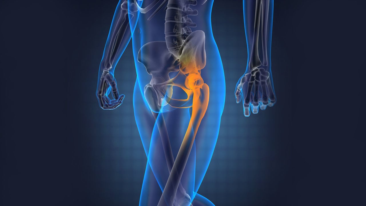 Hip Dislocation Treatment Kalça Çıkığı Tedavisi