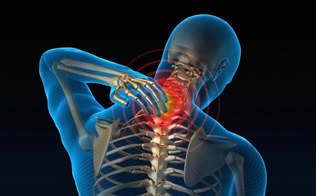 Blog Osteoporosis in Young Adults